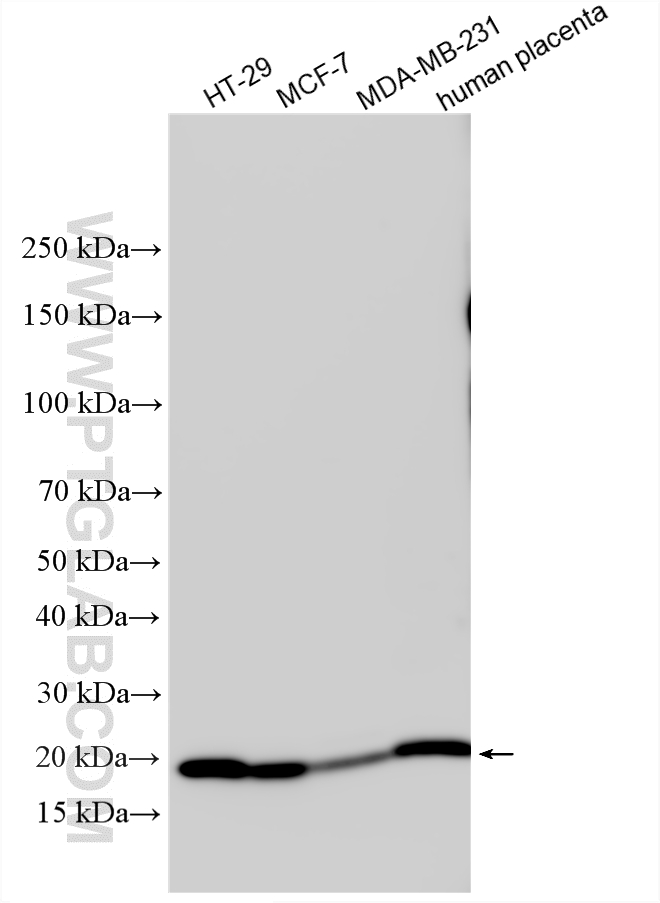 Various lysates were subjected to SDS PAGE followed by western blot with 16195-1-AP (Claudin 4-specific antibody) at dilution of 1:6000 incubated at room temperature for 1.5 hours. WB analysis using 16195-1-AP