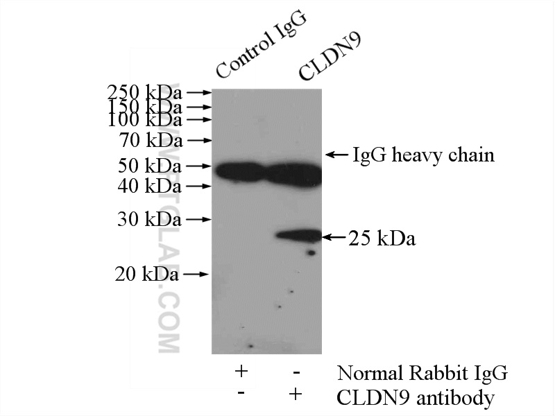 IP experiment of HeLa using 16196-1-AP