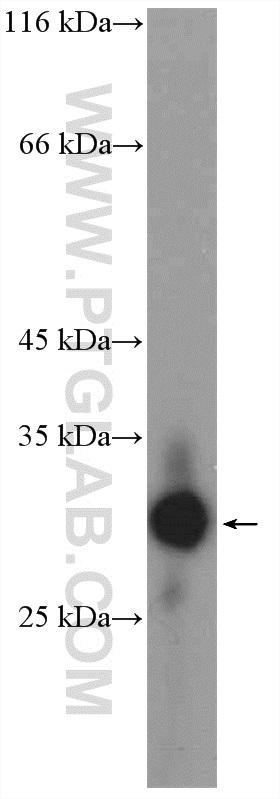 WB analysis of HeLa using 16196-1-AP