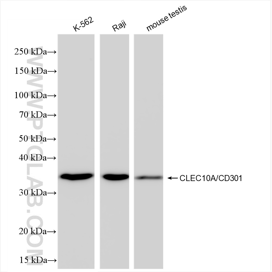 CLEC10A/CD301
