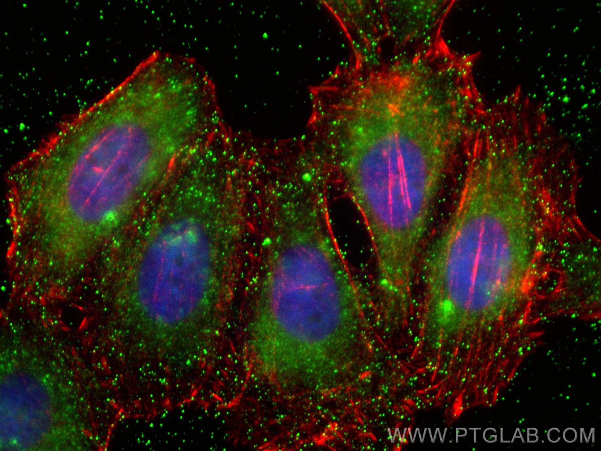 IF Staining of HepG2 using 60295-1-Ig (same clone as 60295-1-PBS)