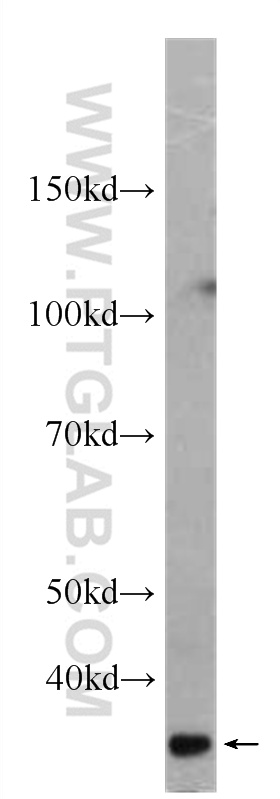 WB analysis of human heart using 60295-1-Ig