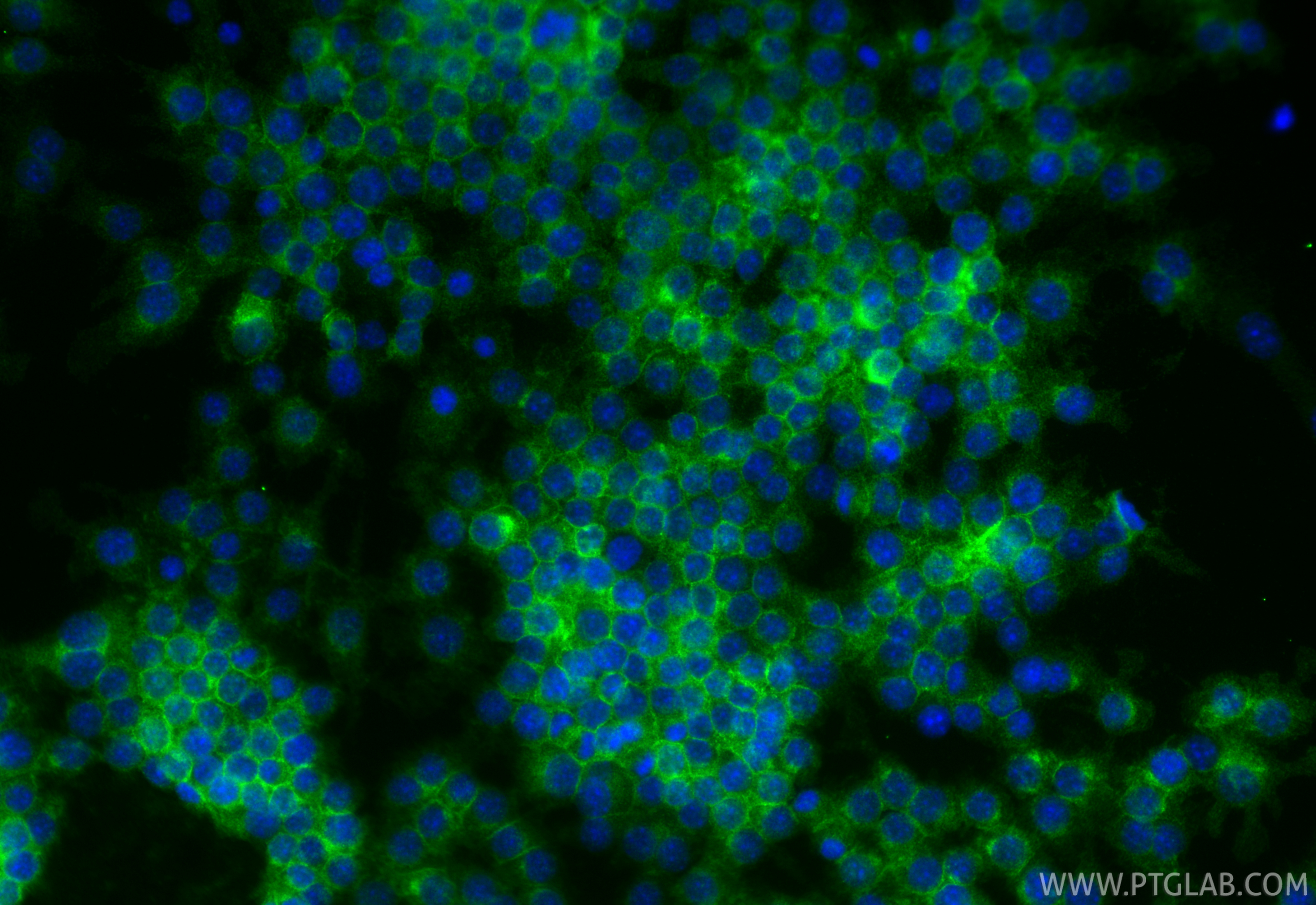 IF Staining of RAW 264.7 using 98357-1-RR (same clone as 98357-1-PBS) IF Staining of RAW 264.7 using 98357-1-RR (same clone as 98357-1-PBS)