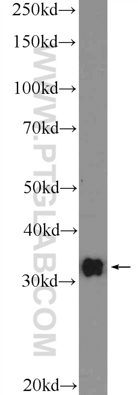 WB analysis of mouse brain using 26077-1-AP