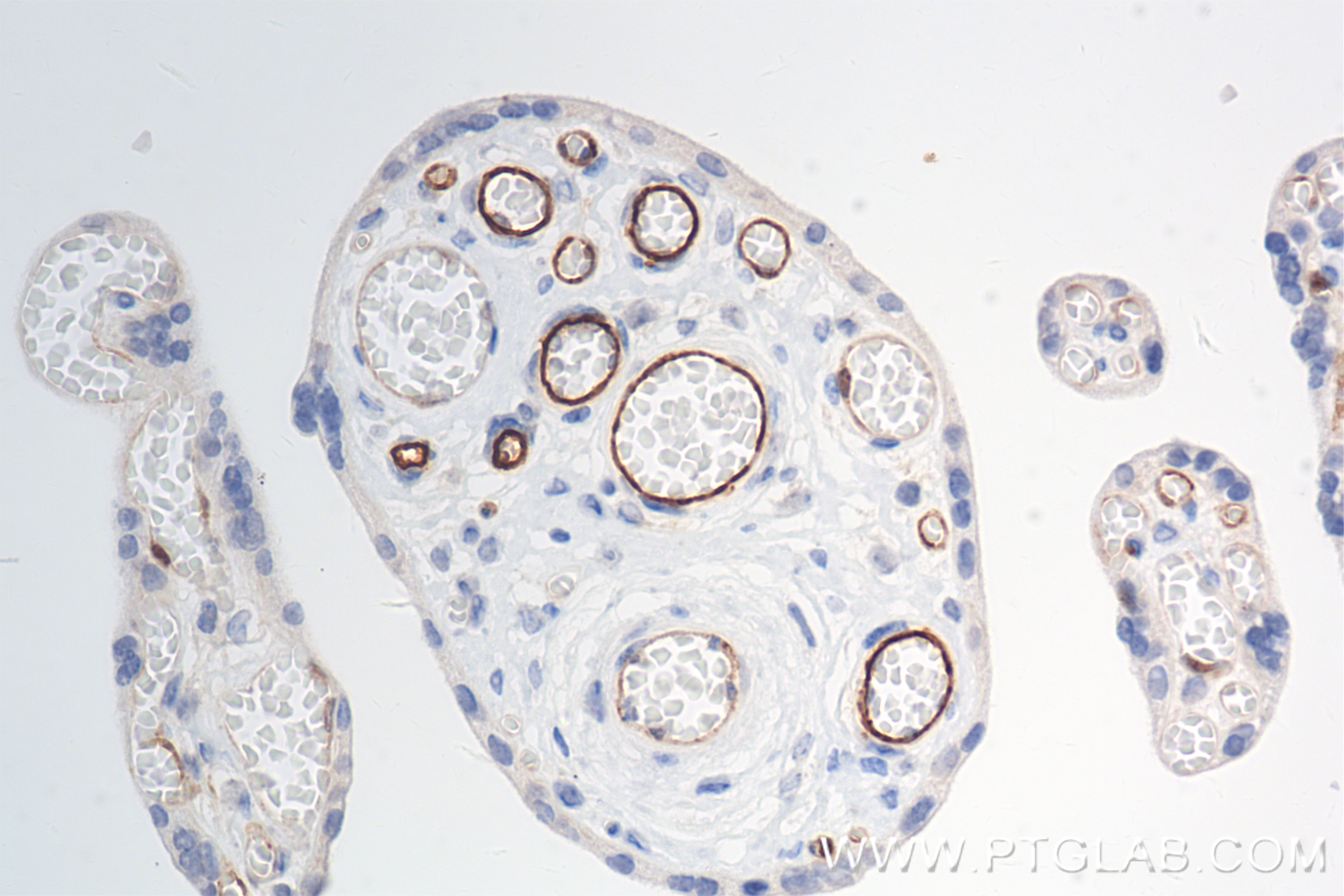 IHC staining of human placenta using 84327-1-RR (same clone as 84327-1-PBS)