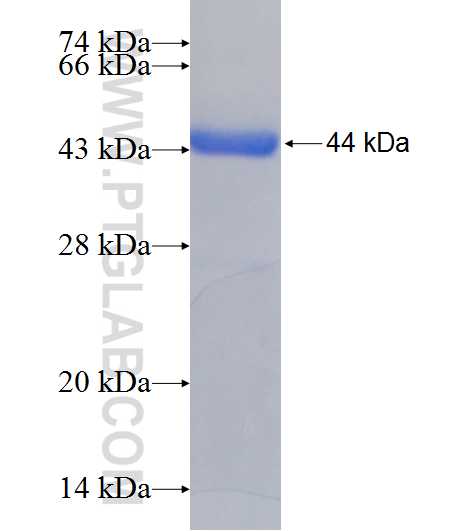 CLEC14A fusion protein Ag21081 SDS-PAGE