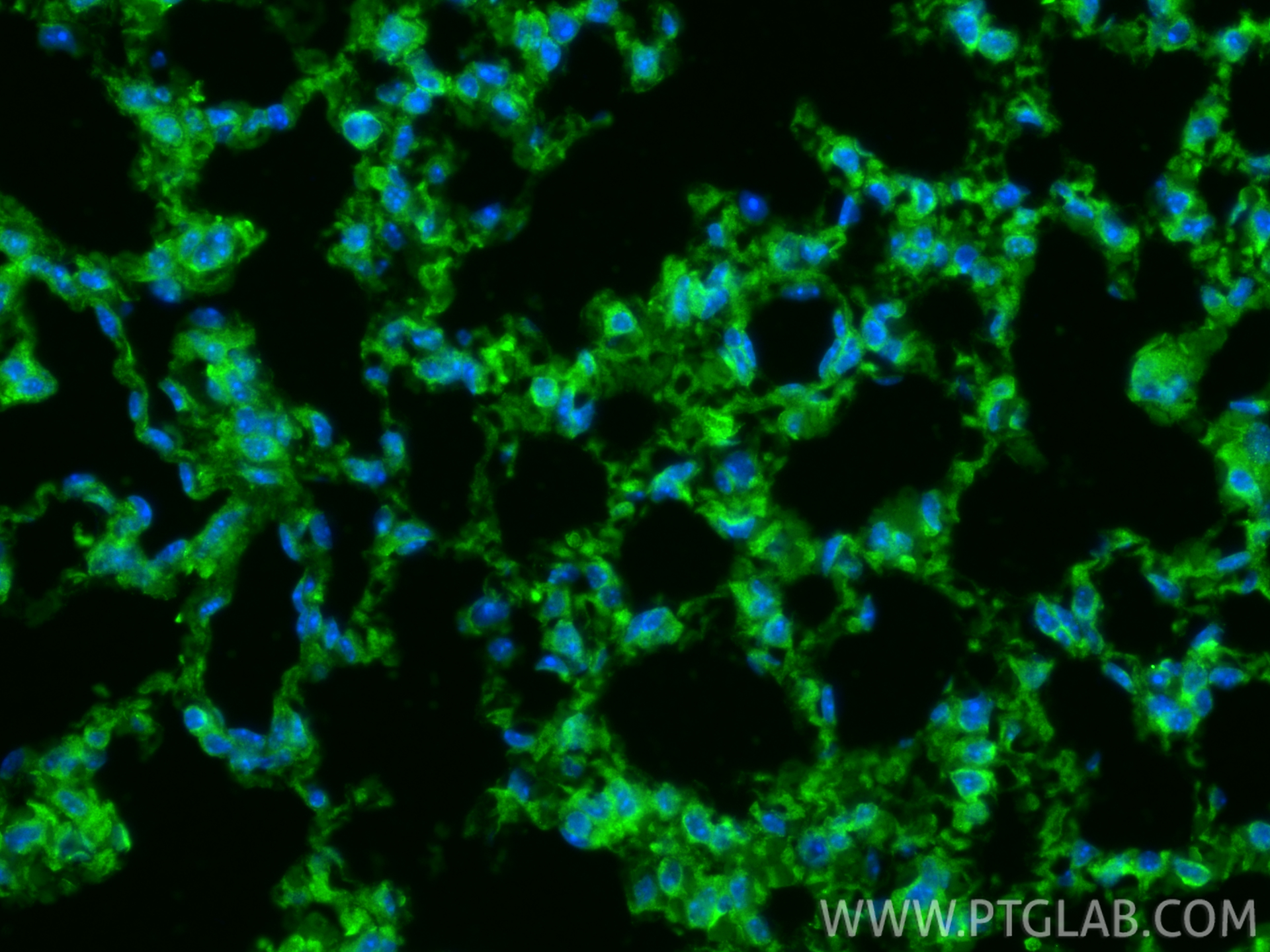 IF Staining of mouse lung using 13394-1-AP IF Staining of mouse lung using 13394-1-AP