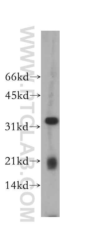 CLEC1A