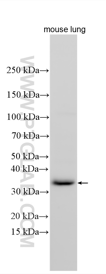 Various lysates were subjected to SDS PAGE followed by western blot with 34093-1-AP (CLEC2/CLEC1B antibody) at dilution of 1:500 incubated at room temperature for 1.5 hours. WB analysis using 34093-1-AP