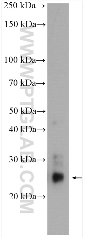 WB analysis of human peripheral blood leukocyte using 18930-1-AP