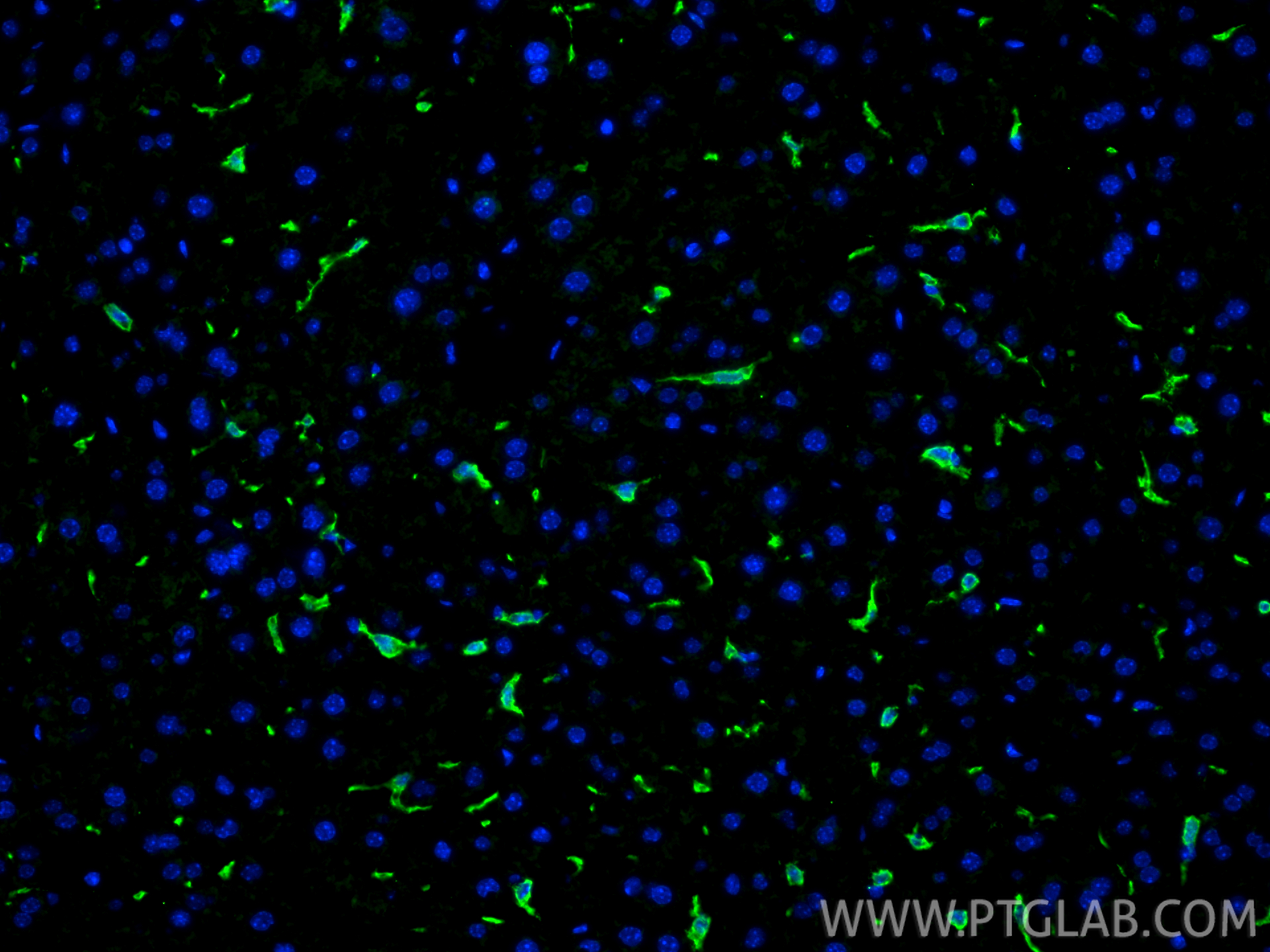 IF Staining of mouse liver using 34238-1-AP