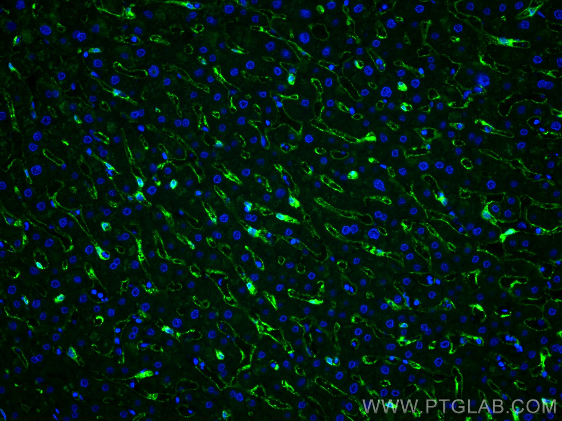 IF Staining of human liver using 18173-1-AP