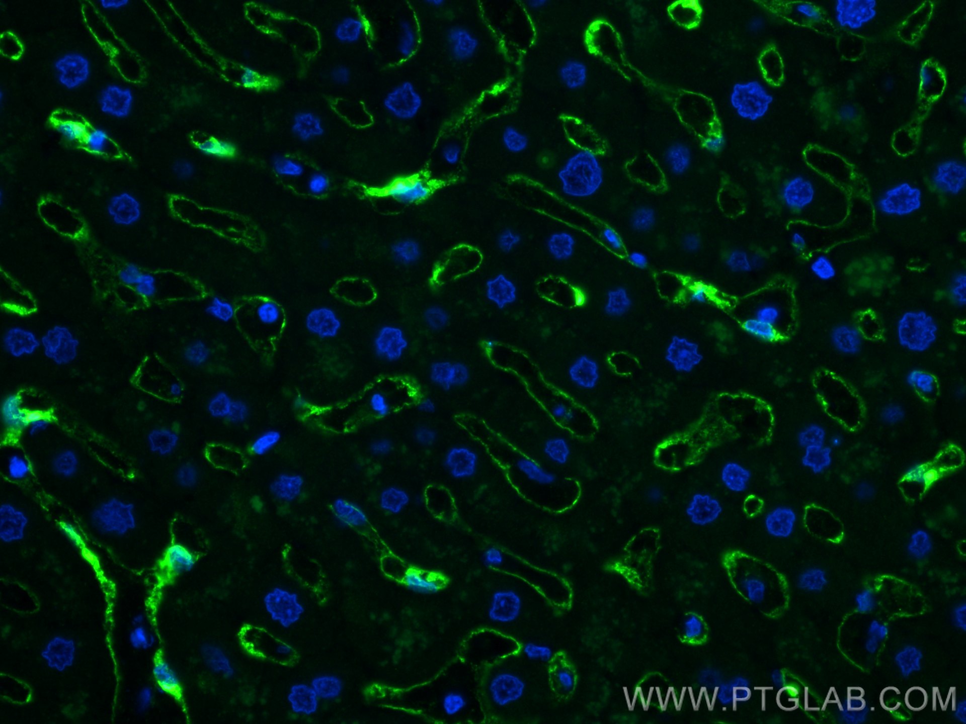 IF Staining of human liver using 18173-1-AP