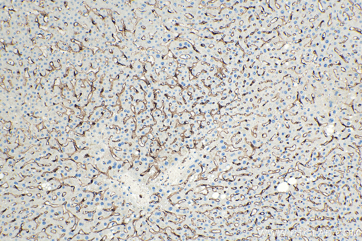 IHC staining of human liver using 18173-1-AP