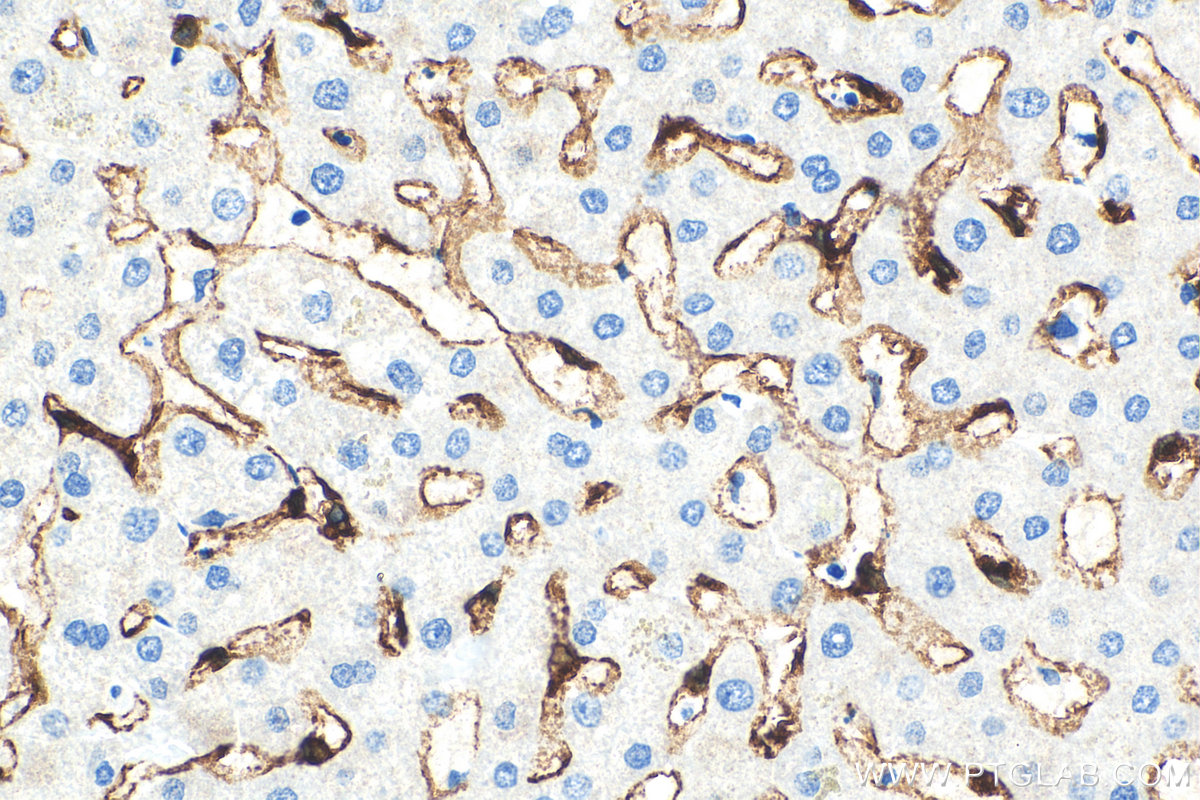 IHC staining of human liver using 18173-1-AP