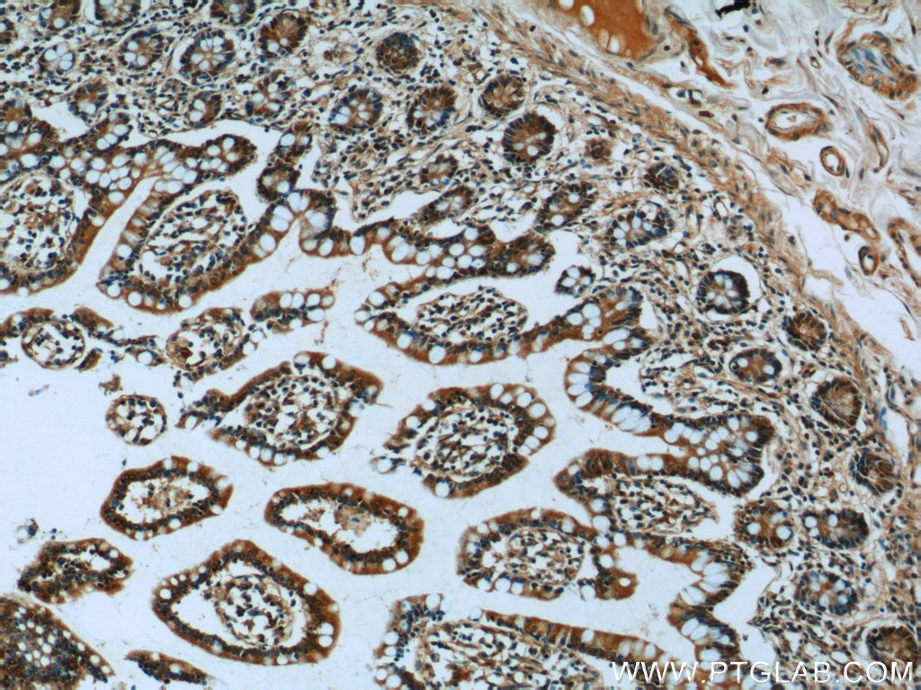 IHC staining of human small intestine using 14545-1-AP