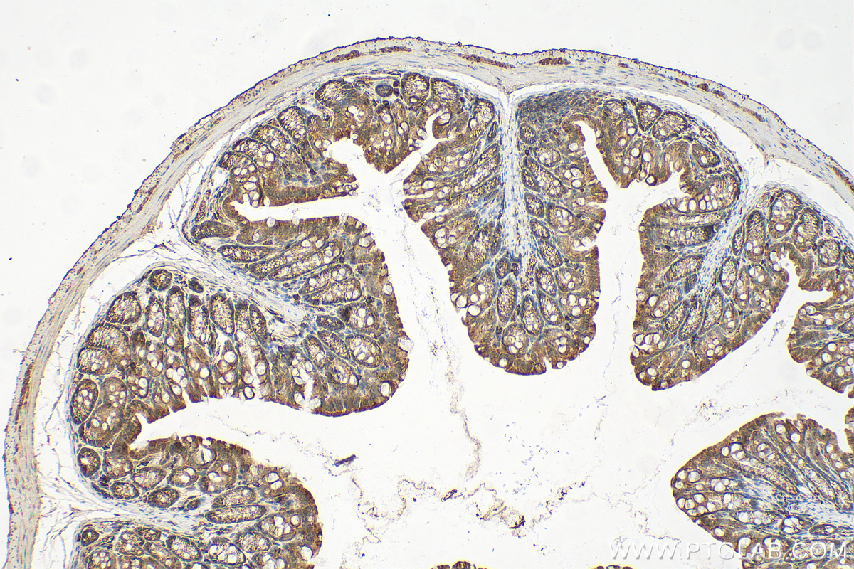 IHC staining of mouse colon using 14545-1-AP