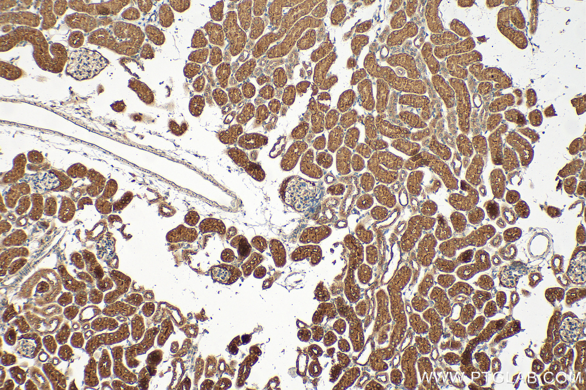 IHC staining of mouse kidney using 14545-1-AP
