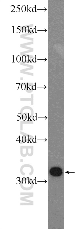 WB analysis of HL-60 using 14545-1-AP