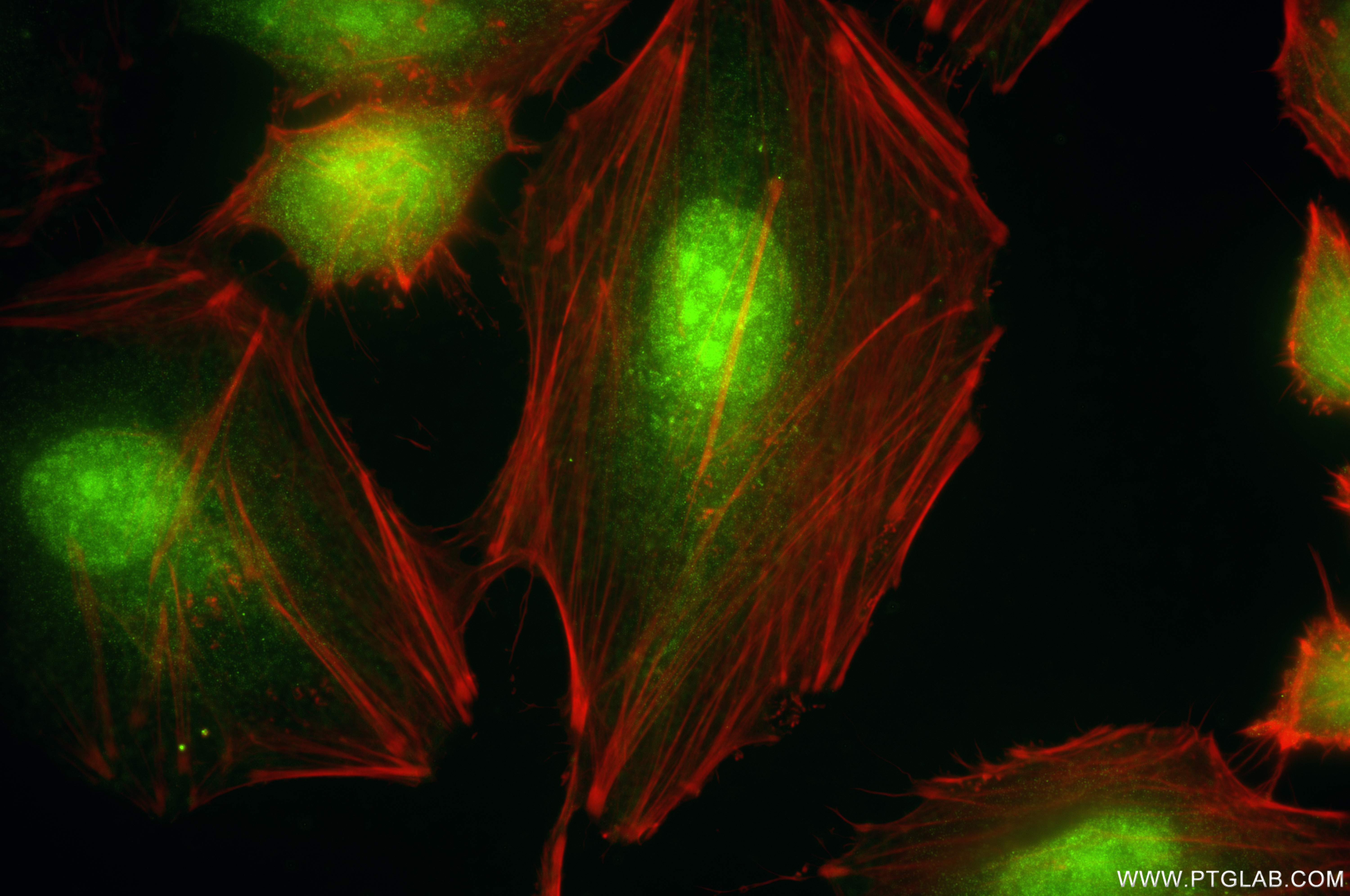IF Staining of HeLa using 85831-4-RR
