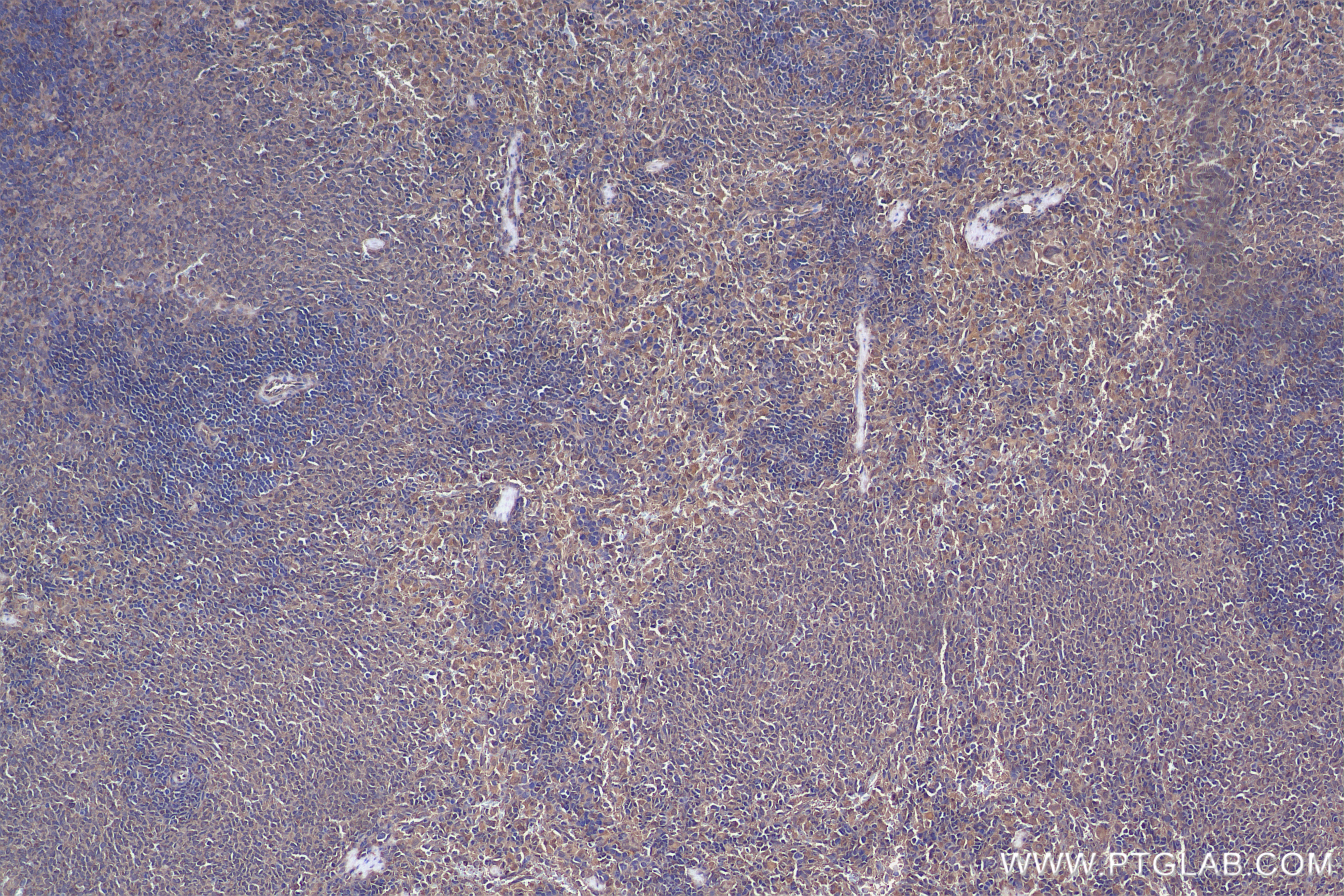 IHC staining of rat spleen using 85831-4-RR