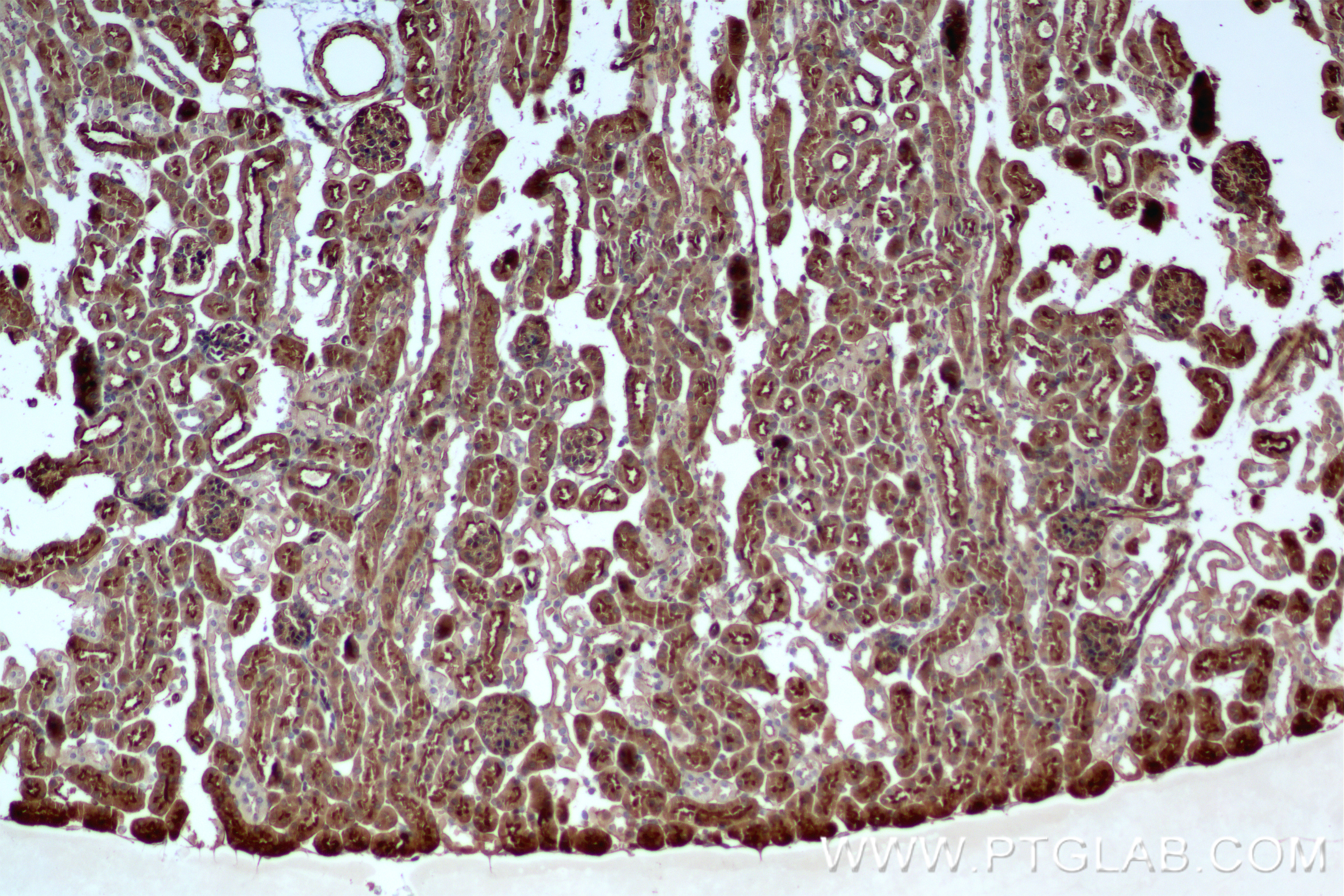 IHC staining of mouse kidney using 85831-4-RR
