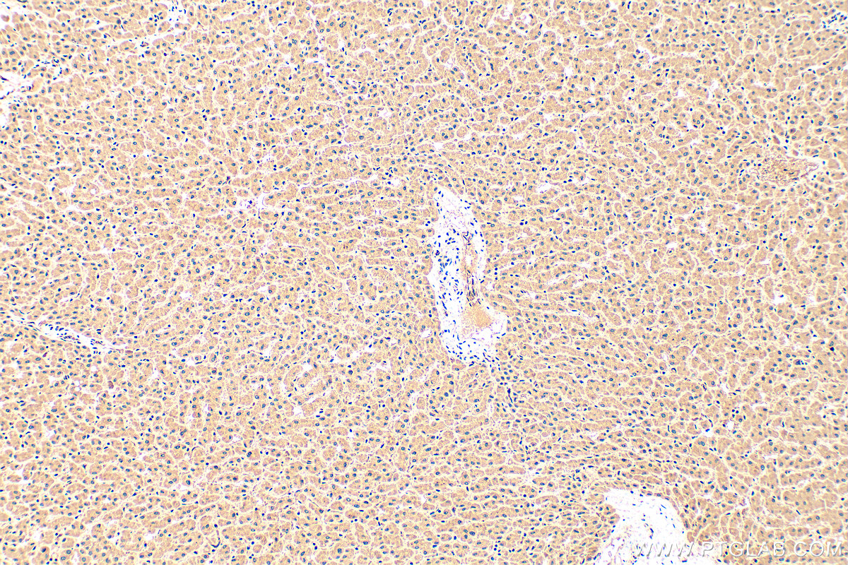 IHC staining of human liver using 14935-1-AP