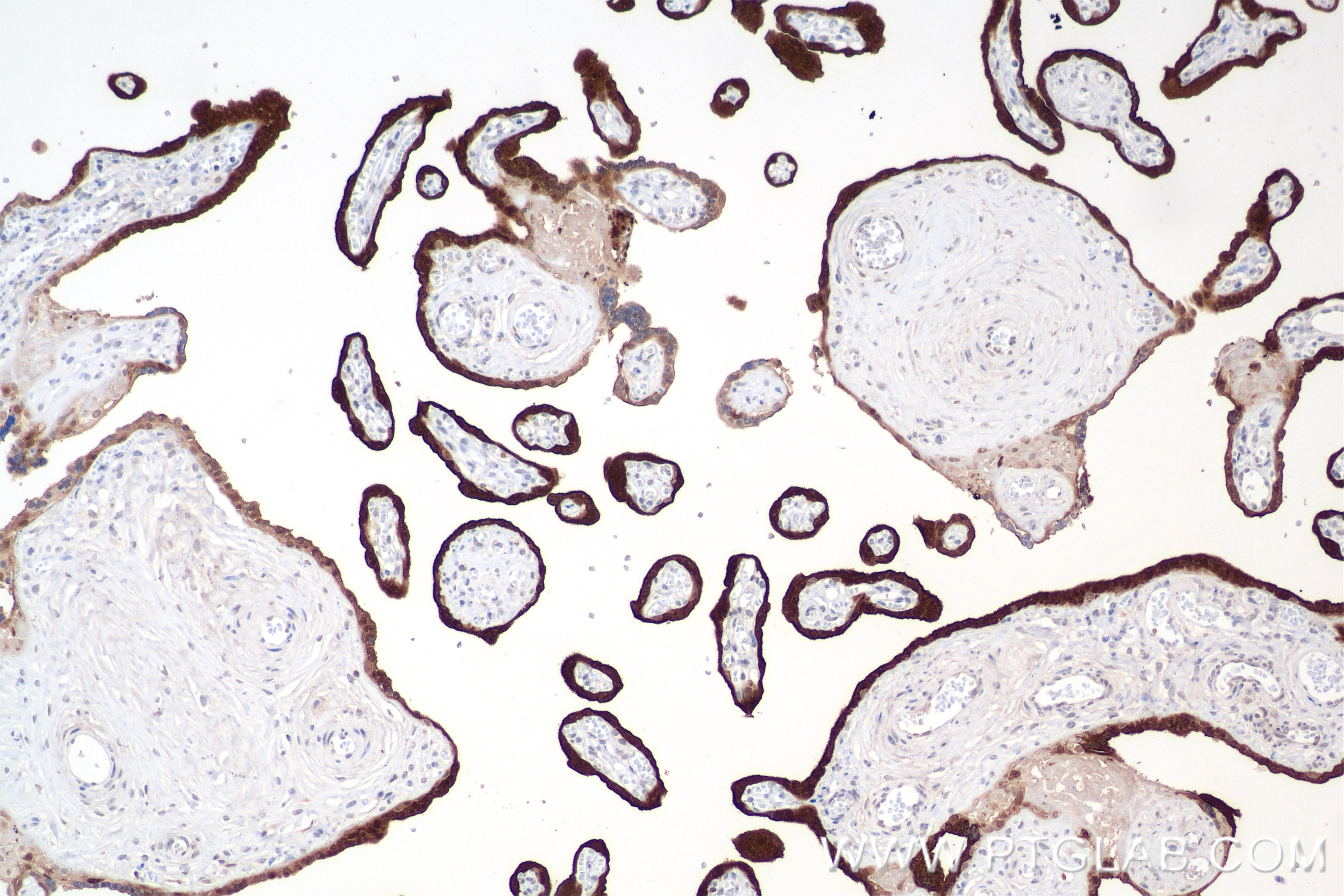 IHC staining of human placenta using 84759-4-RR (same clone as 84759-4-PBS)