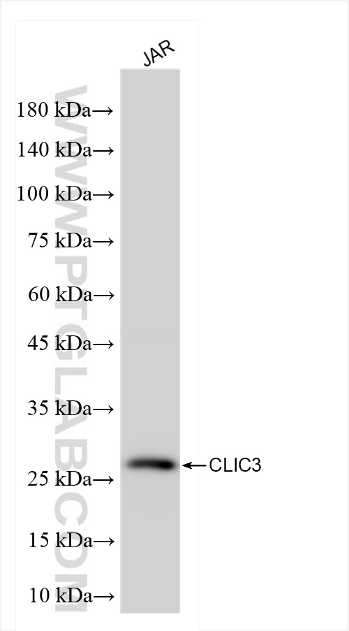 WB analysis of JAR using 84759-4-RR