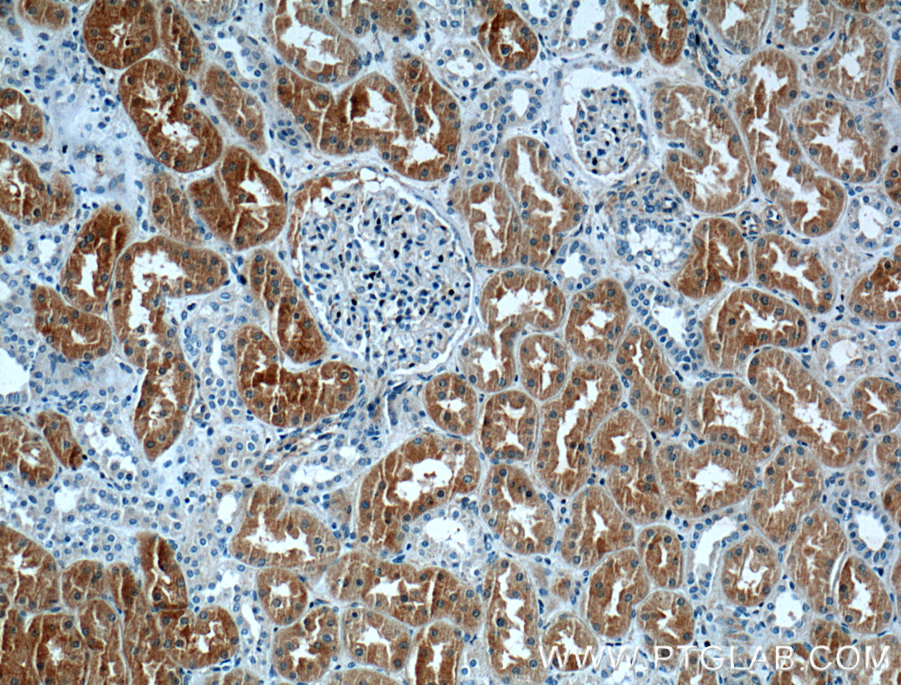 IHC staining of human kidney using 12298-2-AP