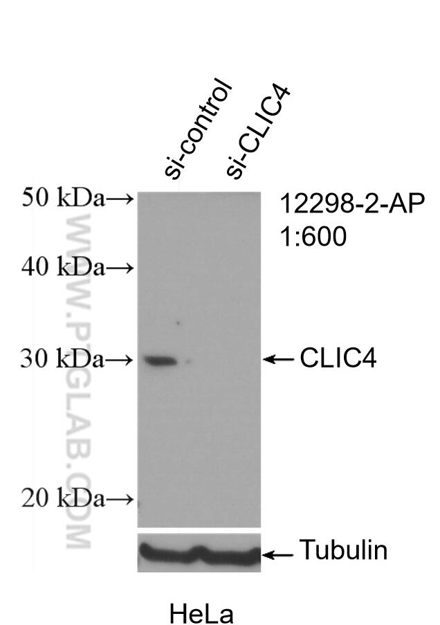 WB analysis of HeLa using 12298-2-AP