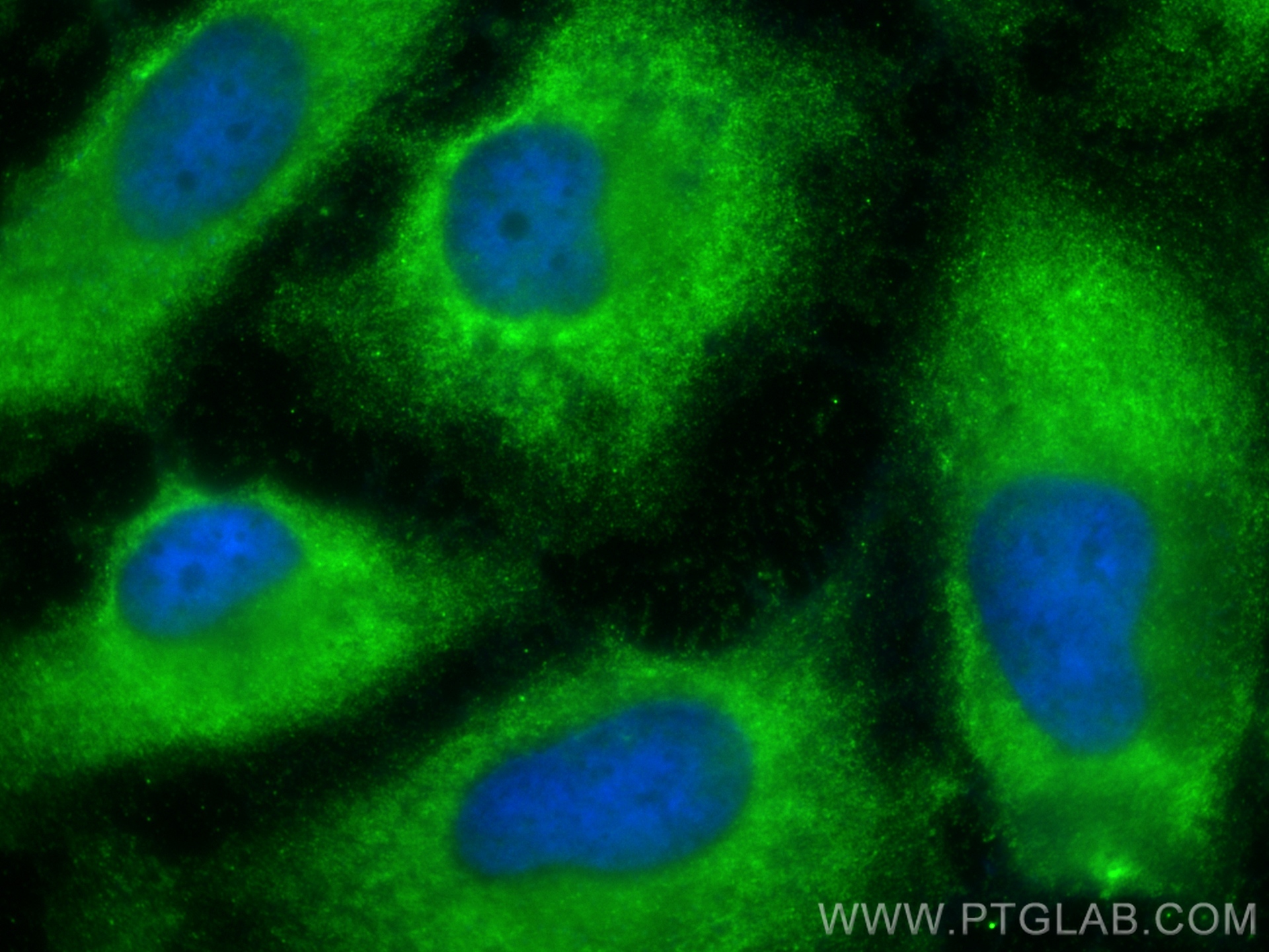 IF Staining of HeLa using 66343-1-Ig (same clone as 66343-1-PBS)