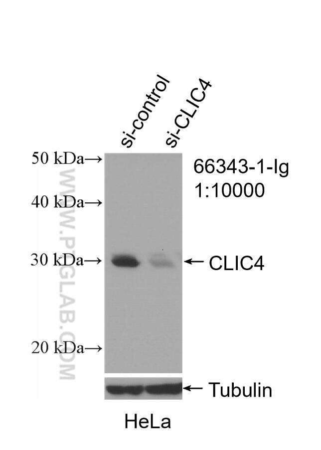 WB analysis of HeLa using 66343-1-Ig (same clone as 66343-1-PBS)