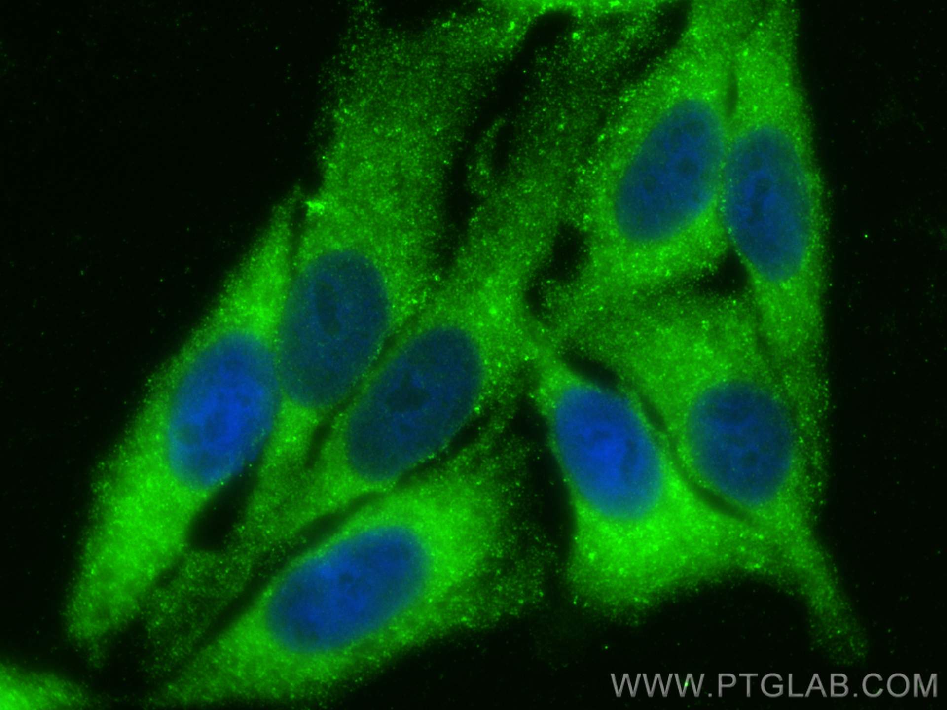 IF Staining of HepG2 using 10470-1-AP