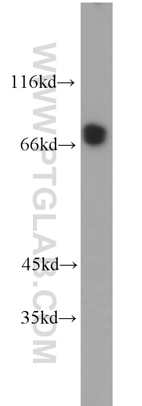 WB analysis of HeLa using 10470-1-AP