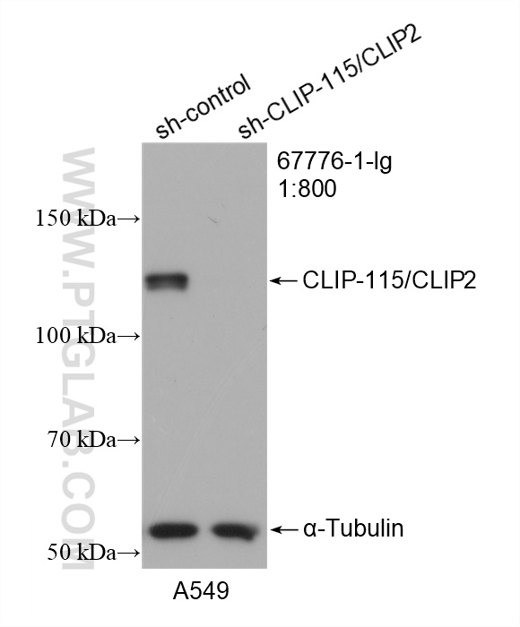 WB analysis of A549 using 67776-1-Ig