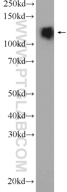 WB analysis of mouse brain using 25088-1-AP