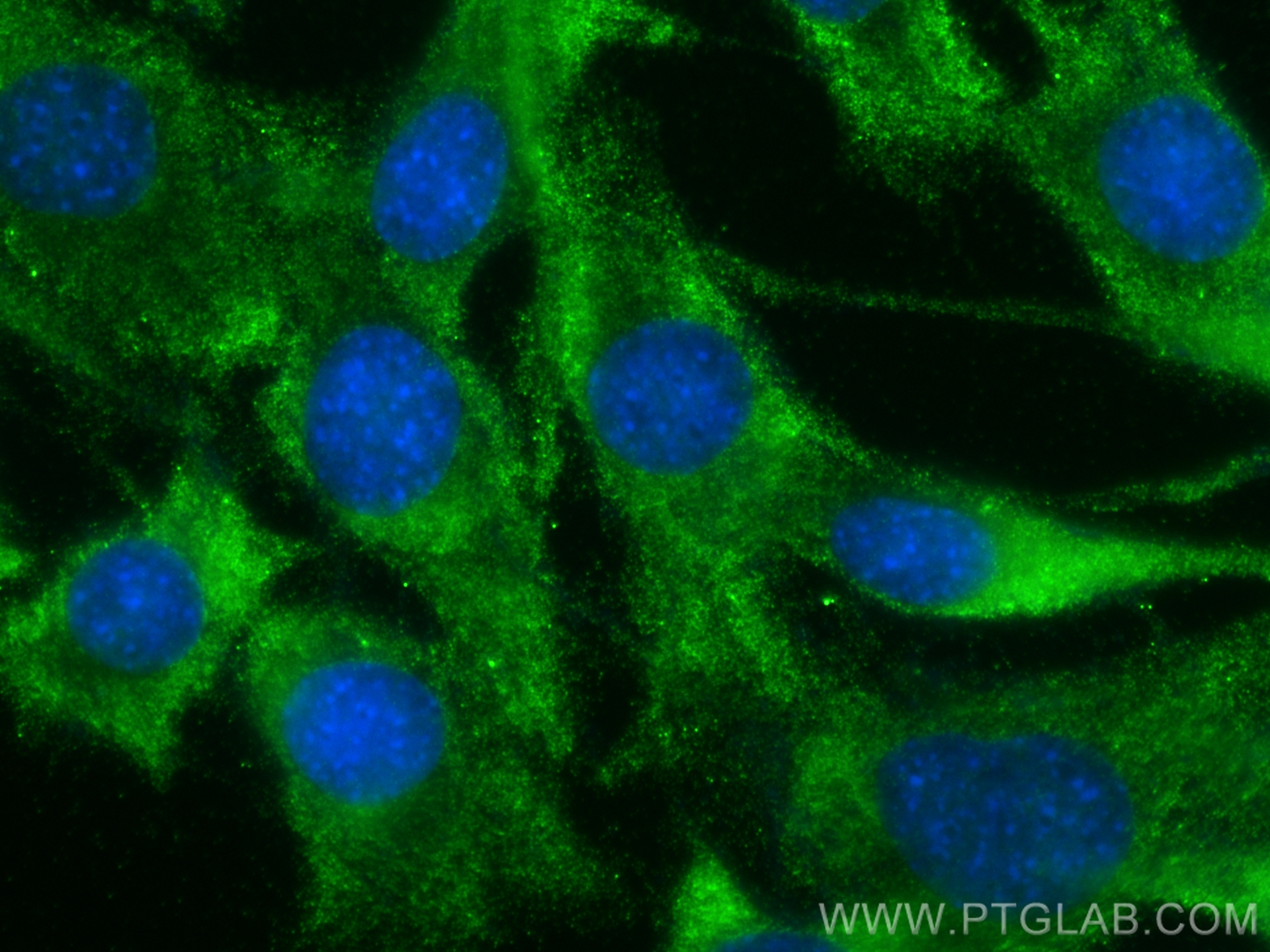 IF Staining of C2C12 using 17044-1-AP