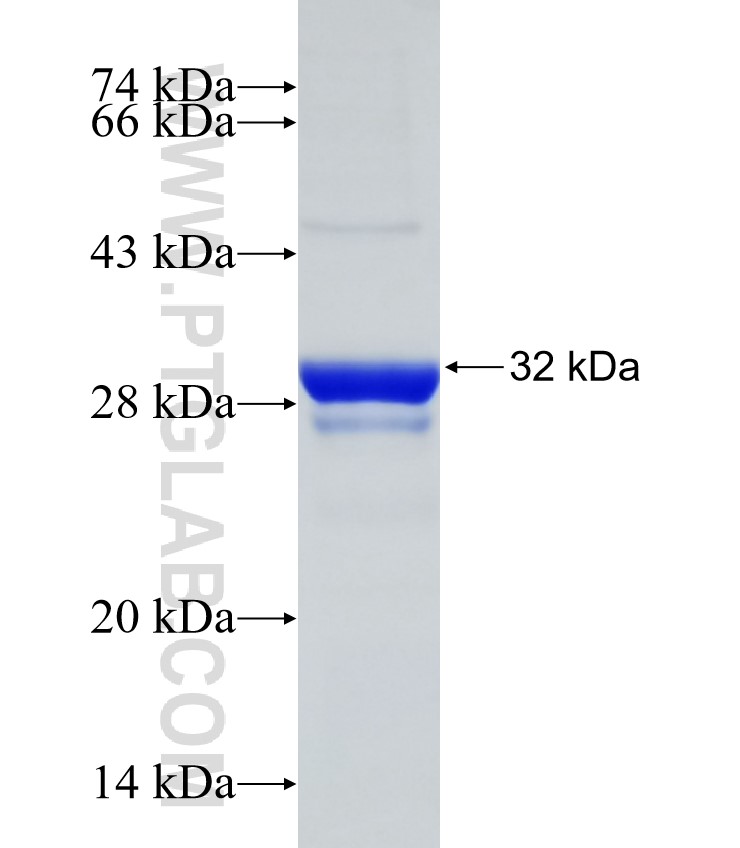 CLN3 fusion protein Ag31784 SDS-PAGE CLN3 fusion protein Ag31784 SDS-PAGE