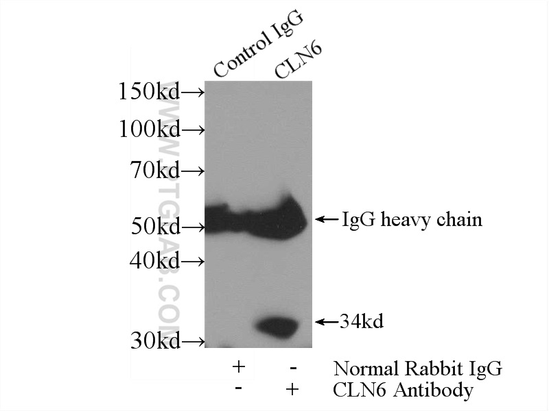 IP experiment of HEK-293 using 20315-1-AP