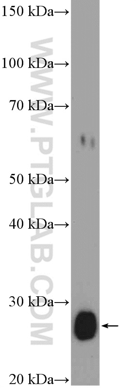 WB analysis of SH-SY5Y using 20315-1-AP