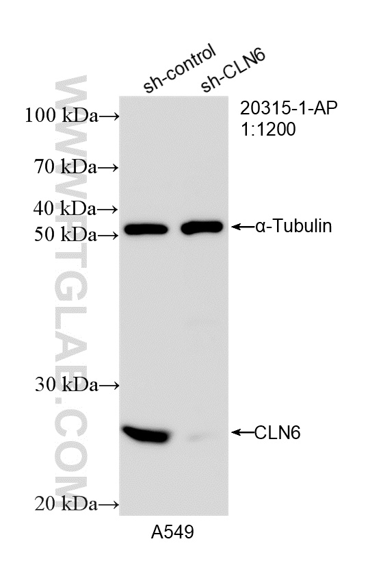 WB analysis of HeLa using 20315-1-AP WB analysis of HeLa using 20315-1-AP