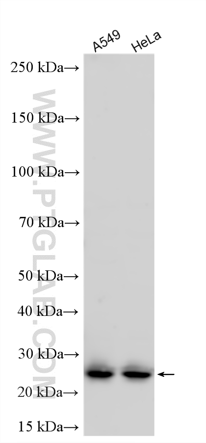 WB analysis using 20315-1-AP WB analysis using 20315-1-AP