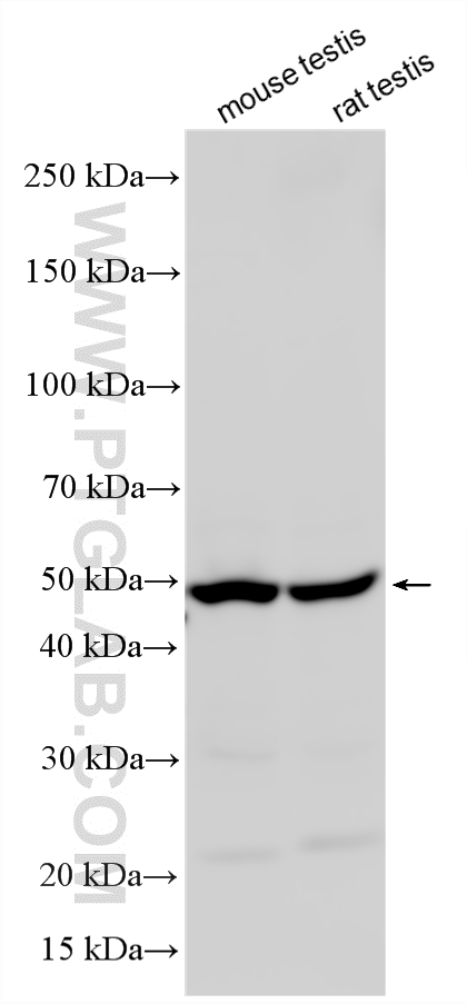 Various lysates were subjected to SDS PAGE followed by western blot with 14746-1-AP (CLP1 antibody) at dilution of 1:1000 incubated at room temperature for 1.5 hours. WB analysis using 14746-1-AP