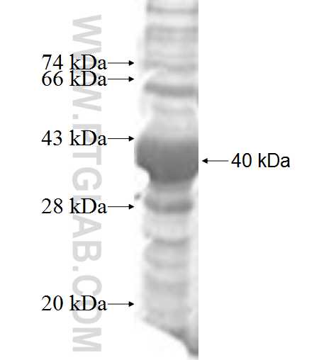 CLP1 fusion protein Ag6537 SDS-PAGE CLP1 fusion protein Ag6537 SDS-PAGE