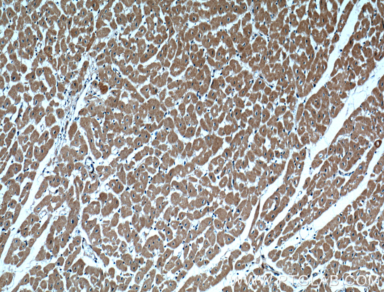 IHC staining of human heart using 15743-1-AP