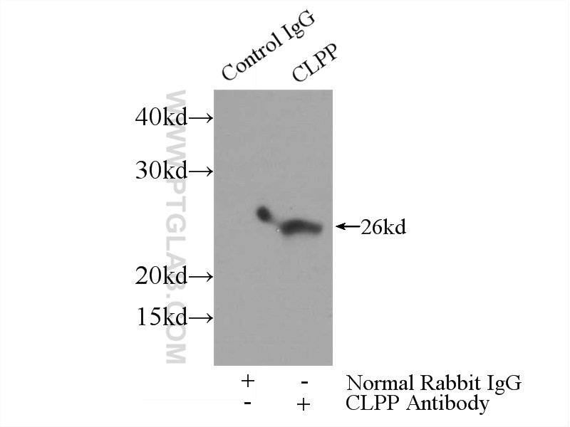 IP experiment of mouse skeletal muscle using 15698-1-AP