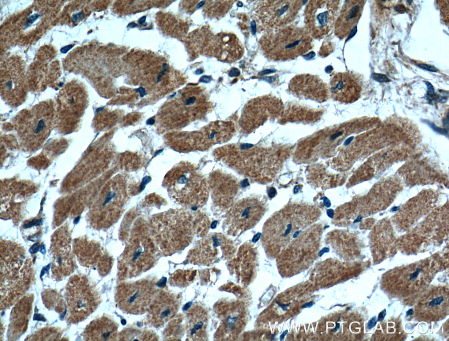 IHC staining of human heart using 66271-1-Ig (same clone as 66271-1-PBS)