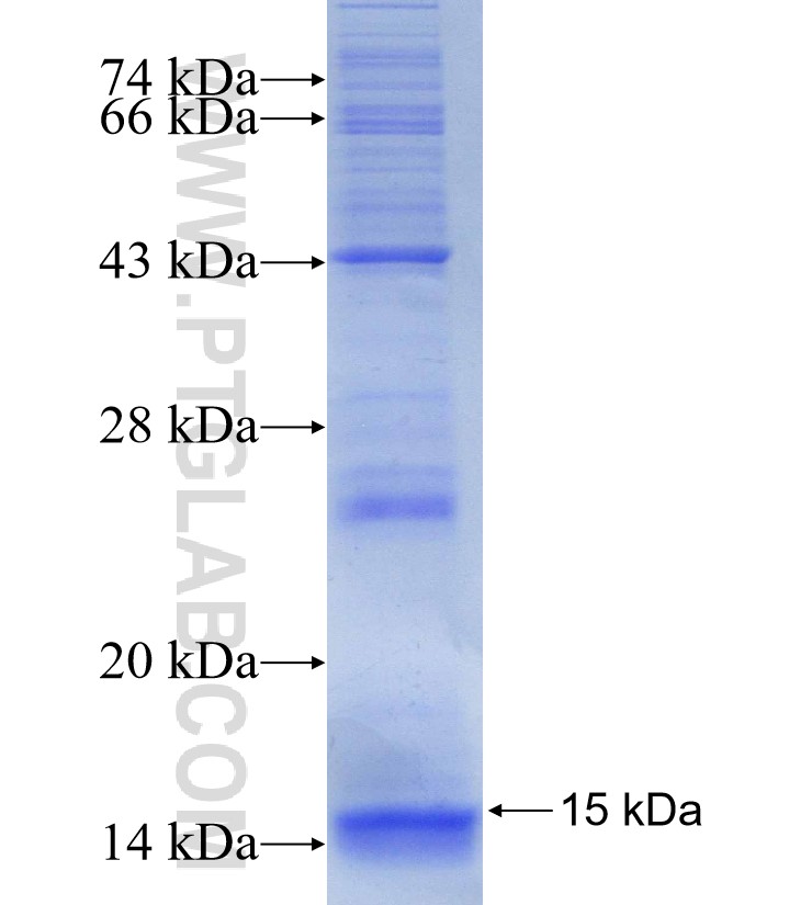 CLPS fusion protein Ag30106 SDS-PAGE CLPS fusion protein Ag30106 SDS-PAGE