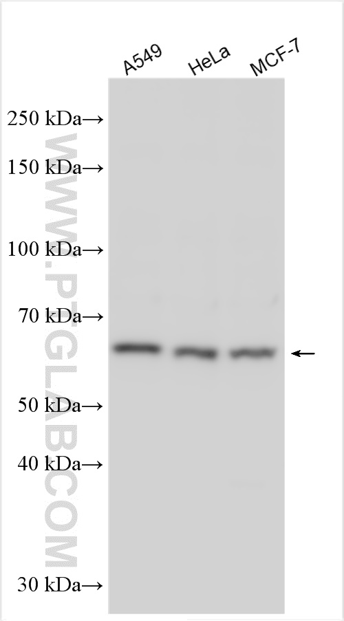 WB analysis using 31050-1-AP